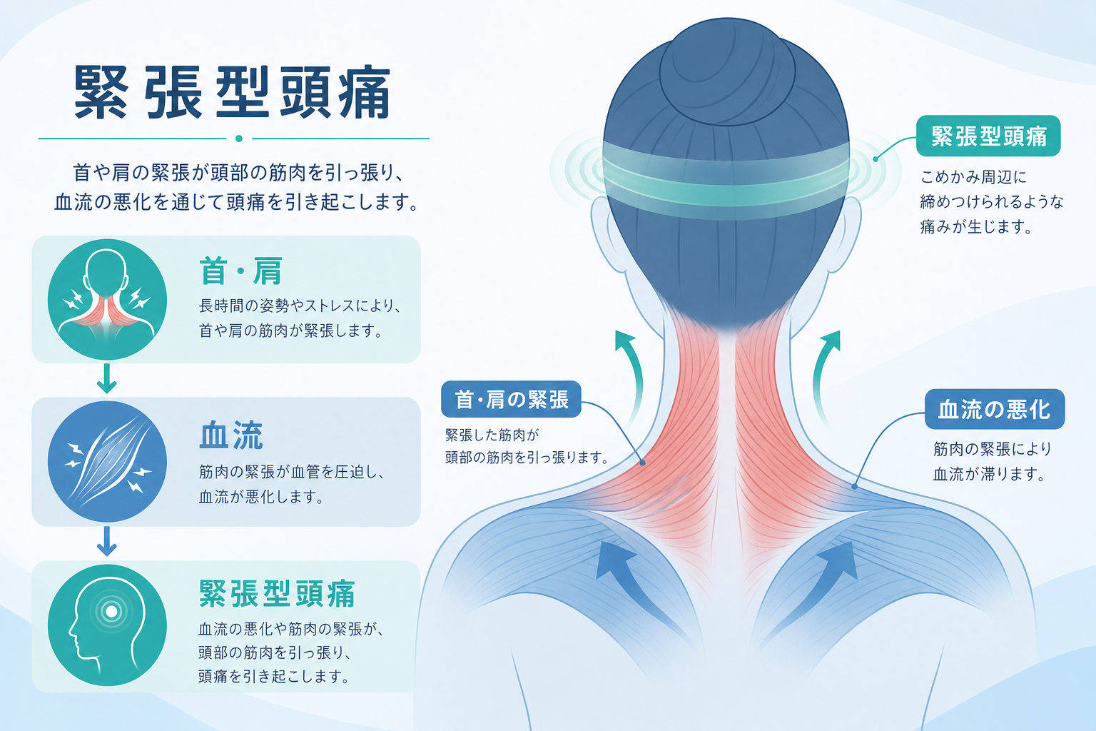 緊張型頭痛と首・肩・血流の関係を示す抽象図解(編集部作成・生成AI)