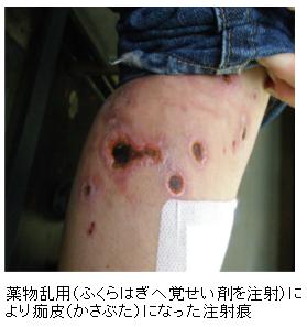 広島県警察ドラッグQ&Aページの広報イラスト。大麻型・覚醒剤型など薬物分類に関する啓発資料の一部。